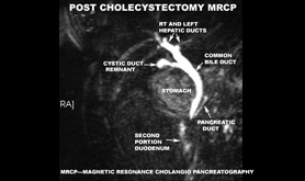 MRCP